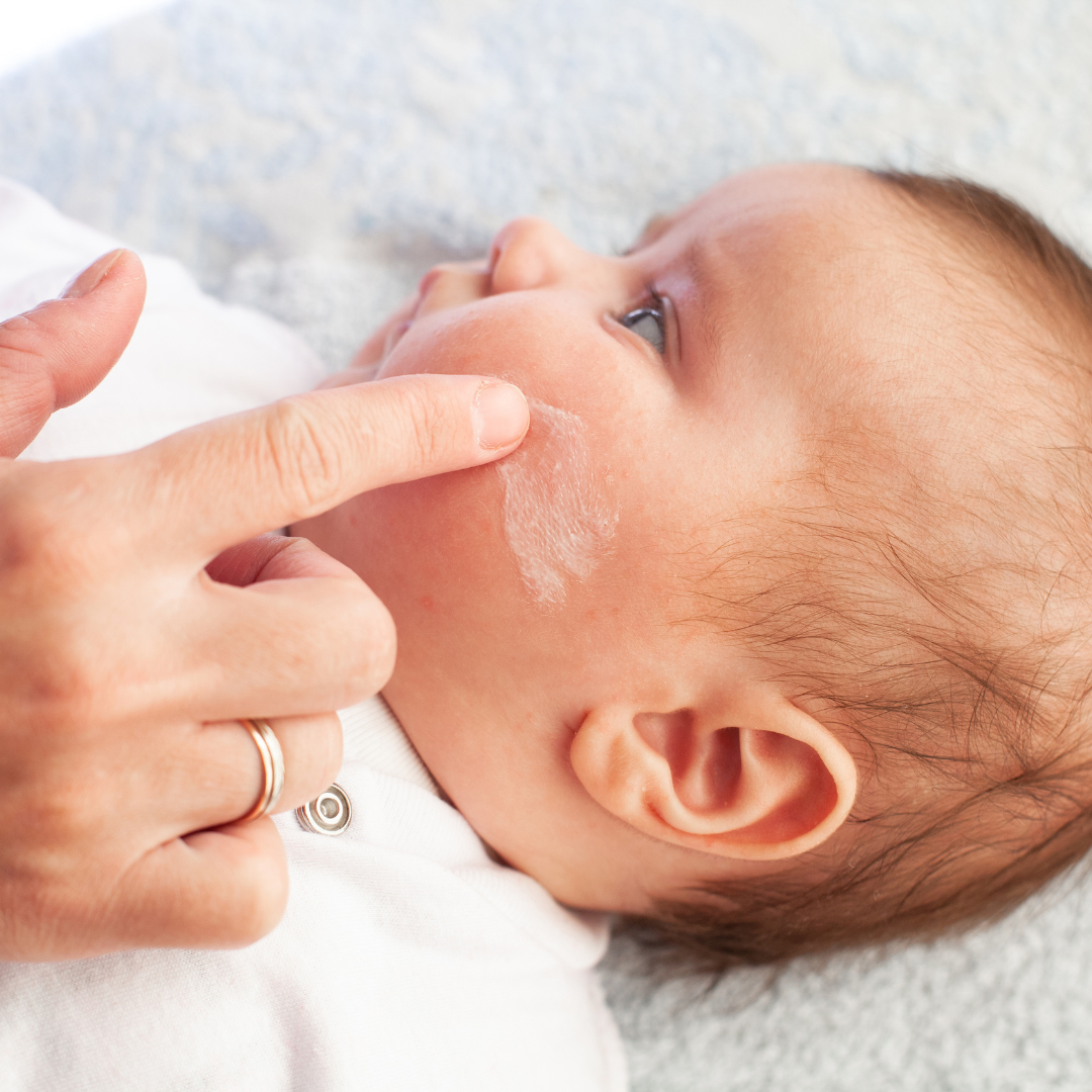 Droge wangetjes bij je baby: oorzaken en oplossingen