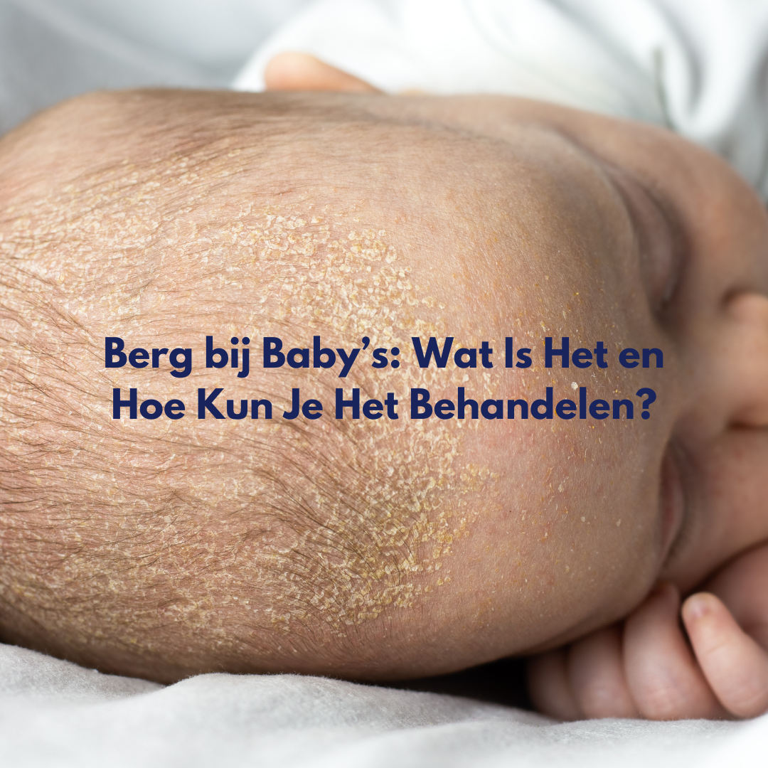 Berg bij Baby’s: Wat Is Het en Hoe Kun Je Het Behandelen?